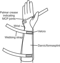 Load image into Gallery viewer, Wrist &amp; Forearm Splint ( Right &amp; Left )
